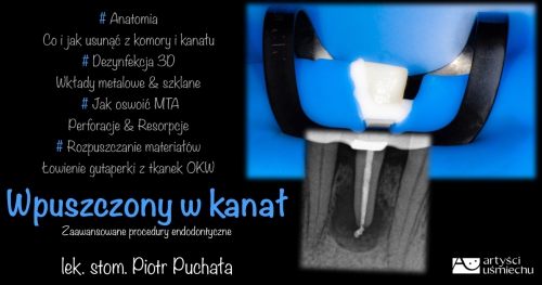 WPUSZCZONY W KANAŁ - Zaawansowane procedury endodontyczne