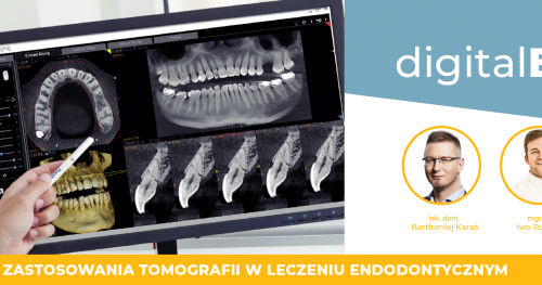 Kompendium zastosowania tomografii stożkowej w leczeniu endodontycznym
