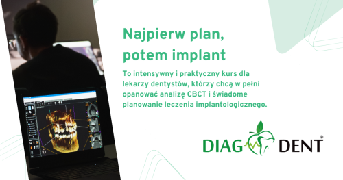 "Najpierw plan, potem implant" - kurs praktycznej analizy CBCT z dr n. med. Pawłem Głębowskim (Warszawa 21-22.05.2026r.)